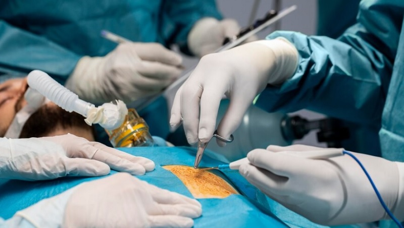 Ilustrasi dokter melakukan transplantasi ginjal-Freepik.com-